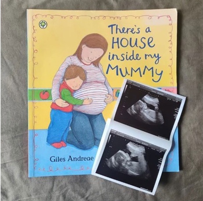 children's book with pregnancy scan on top