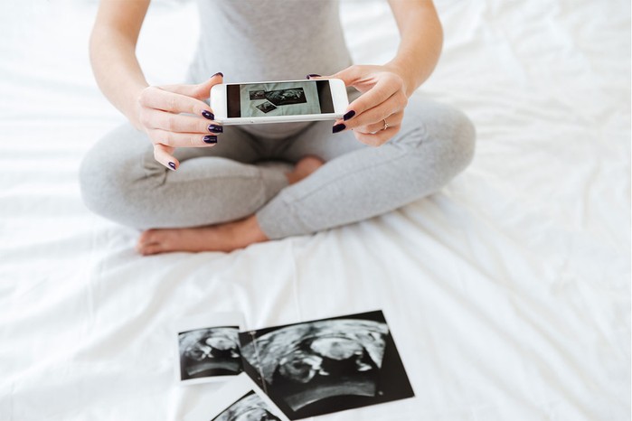 woman taking a picture of a pregnancy scan with her phone